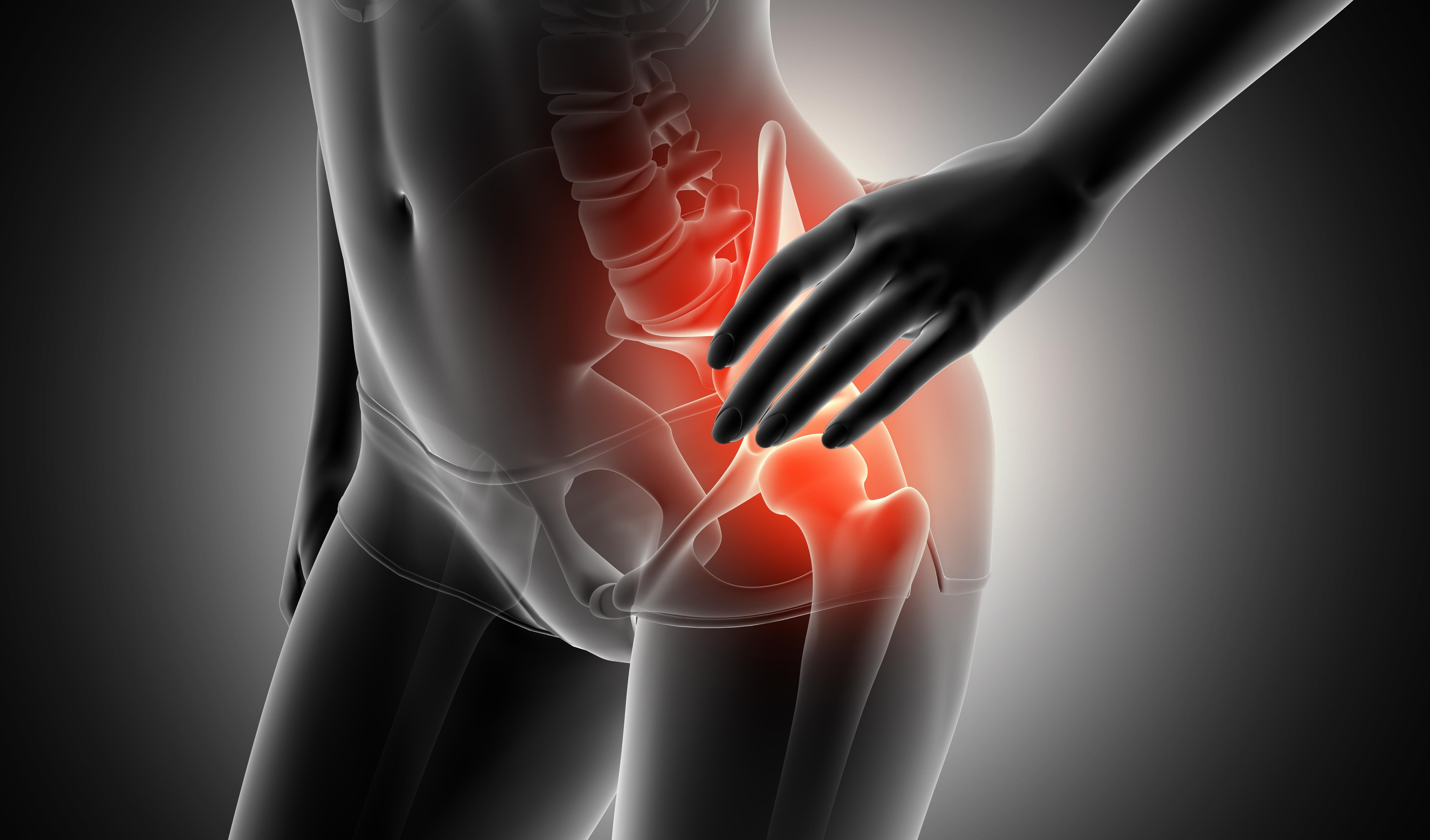 Trocanteritis, bursitis o dolor de maluc